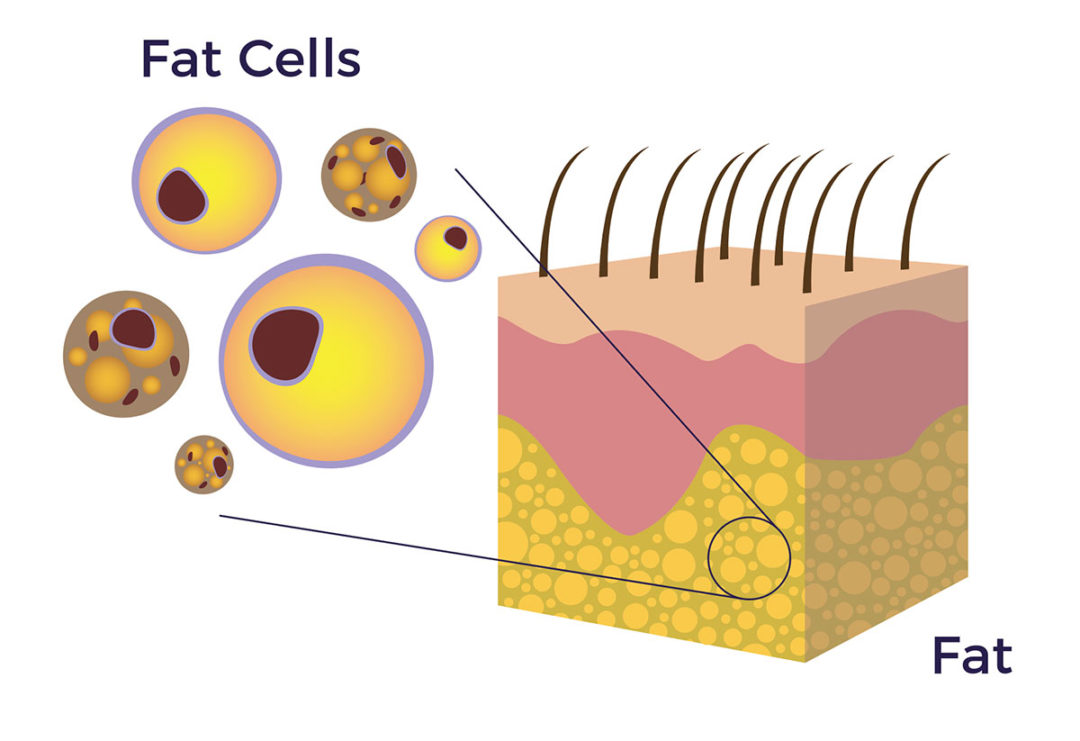 Why Adipose Tissue? (The Skinny on Fat) AMBROSE Cell Therapy