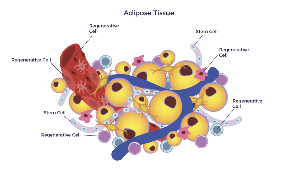 Adipose Tissue - Regenerative Cells (ADRCs)