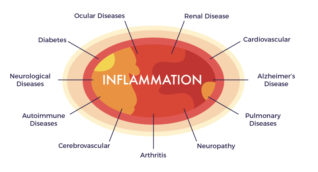 Chronic Inflammation – Is that all there is to disease? - AMBROSE Cell ...