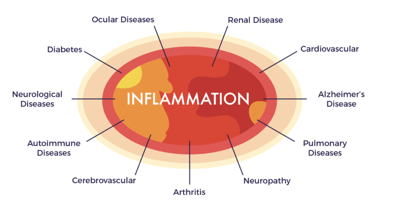 Chronic Inflammation – Is that all there is to disease?  AMBROSE Cell