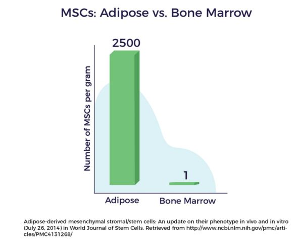 Sources of Stem Cells - Bone Marrow vs Adipose | AMBROSE Cell Therapy