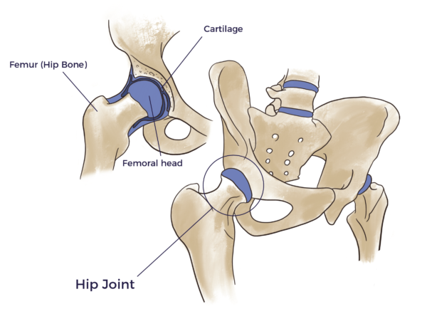 Functional Hip Joint Unit | AMBROSE Cell Therapy for Orthopedic Pain