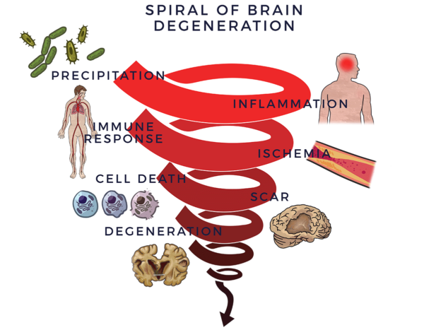 Spiral of Brain Degeneration | AMBROSE Cell Therapy for Brain Diseases and Neurodegenerative Disorders