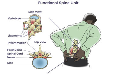 A Golden Era of Cell-Assisted Spine Care Ahead